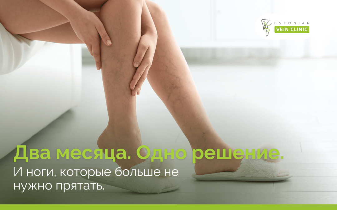 Два месяца, одно решение — и ноги, с которыми не страшно встречать лето