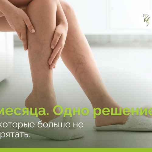 Два месяца, одно решение — и ноги, с которыми не страшно встречать лето