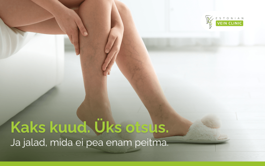 Kaks kuud, üks otsus — ja jalad, millega julgeb suvesse minna